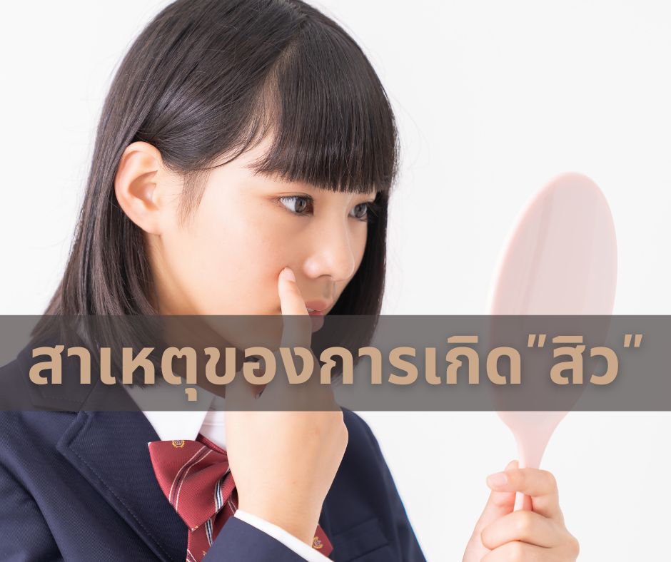 สาเหตุการเกิดสิว